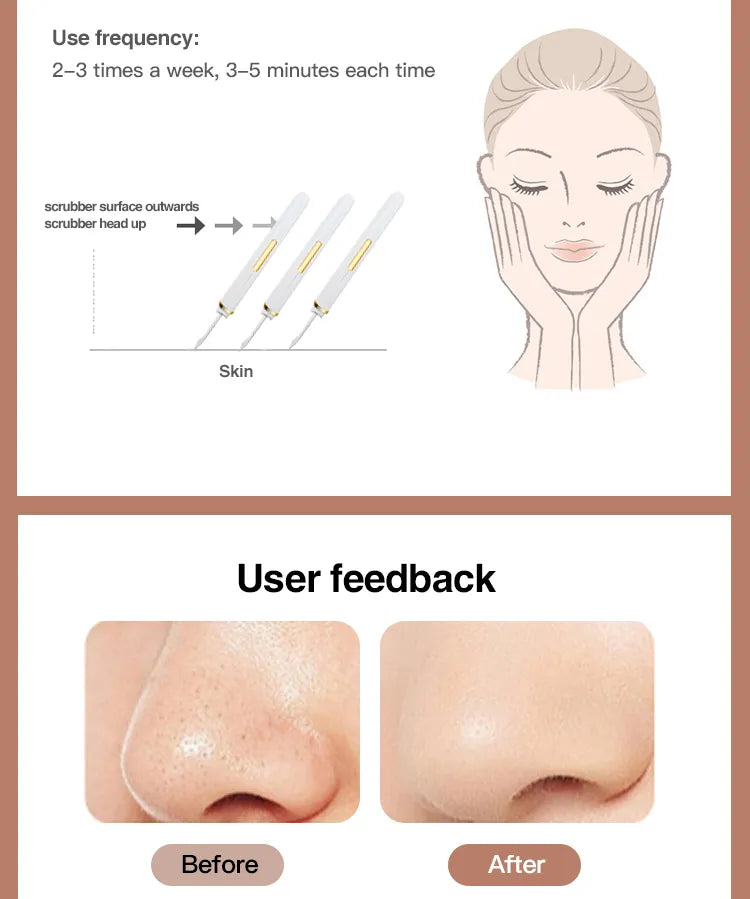 Glow Master UltraSonic Ion Face Scrubber